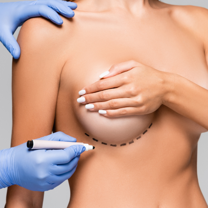 breast plastic surgery dc