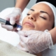 microneedling in dc